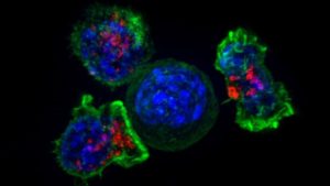 The epigenome plays a significant role in cancer. Image of killer T cells surround a cancer cell.