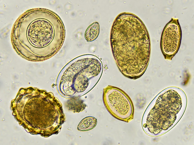 Eggs of helminth in stool, as viewed by a microscope.