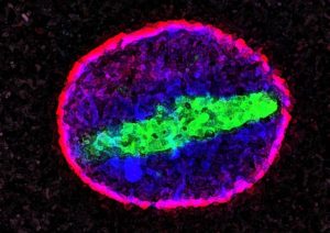 Example of macromolecular damage: A build up of tubulin green in a cell nucleus (pink). Credit: Maximiliano D'Angelo and Martin Hetzer, Salk Institute CC-BY SA 3.0