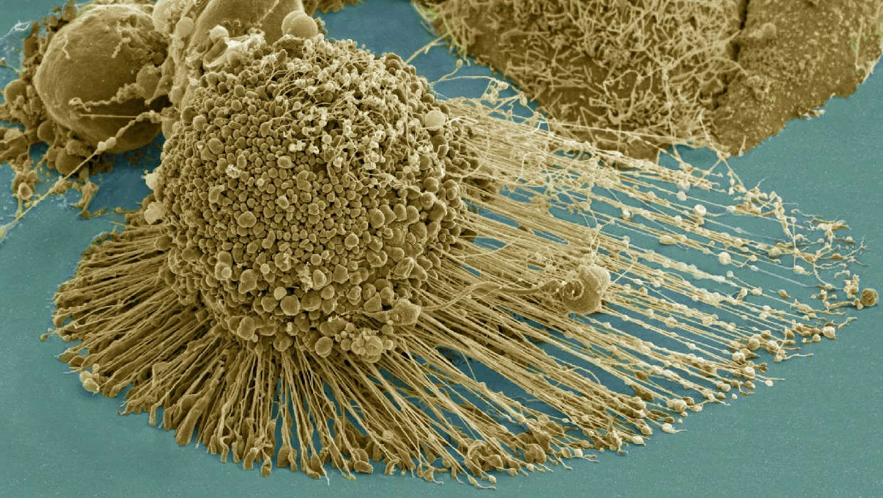 Cell undergoing apoptosis.