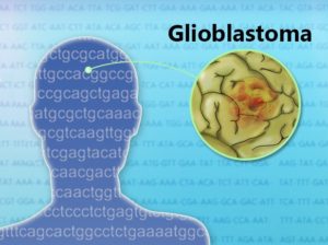 Treating glioblastoma cancer with senolytic drugs. 