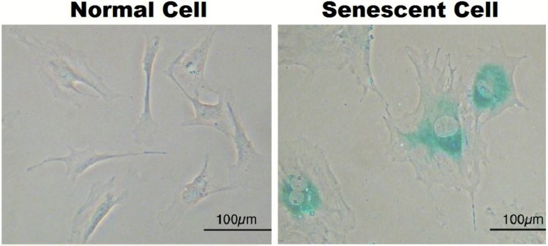 Senescent cells vs. healthy ones.