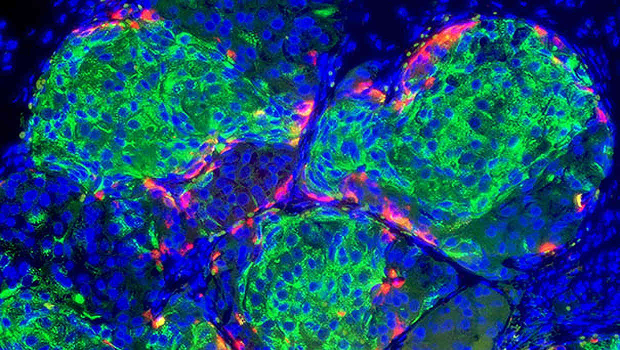 Beta cells in pancreas.