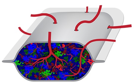 Pancreas in a box, perhaps?