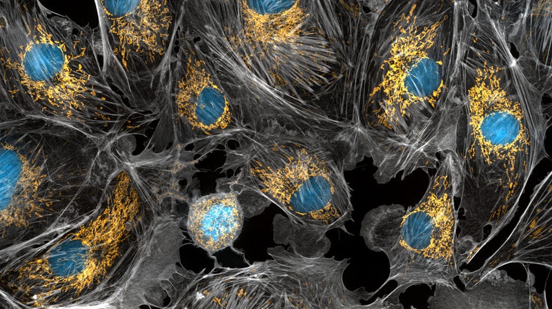 Metabolic changes due to golden mitochondria. The mitochondria are the linchpin of the body's metabolism.