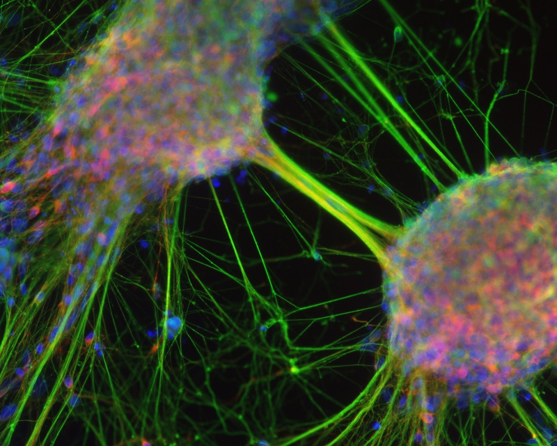 Reverse stem cell decline. Human stem cells forming mature neurons.