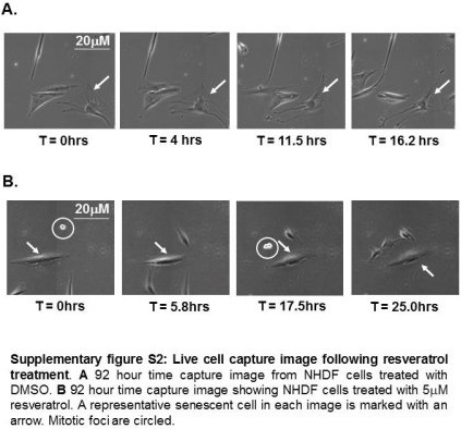 Image comparing cells treated with resveratrol analogs compared to control cells. Image courtesy of the University of Exeter