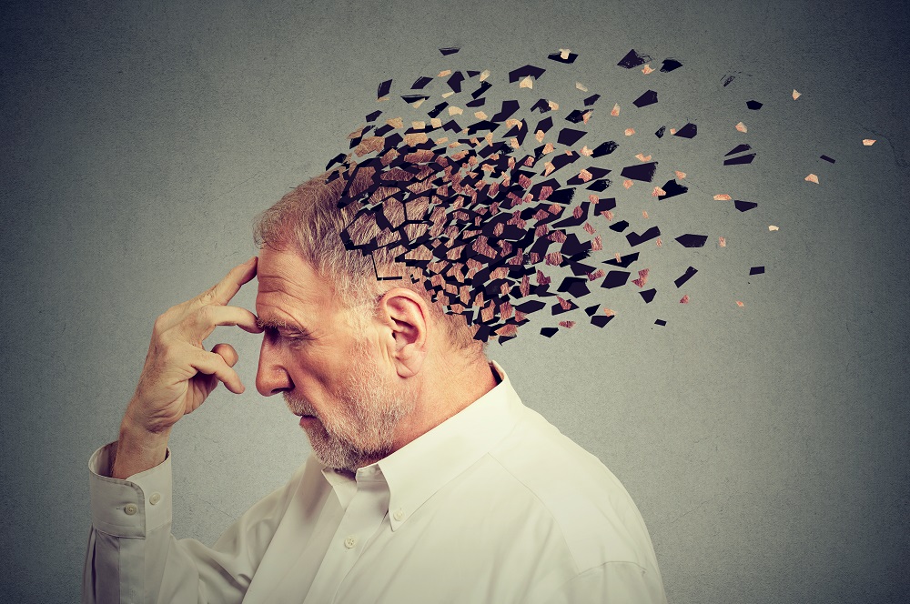 Alzheimer's treatment 1000x664 iStock CHIOSEA_ION getty images