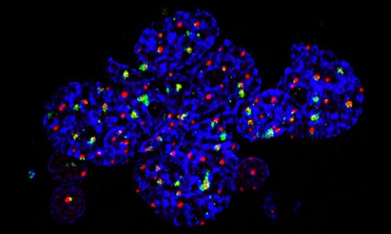 Senescent Cell -Damaged DNA in Green.