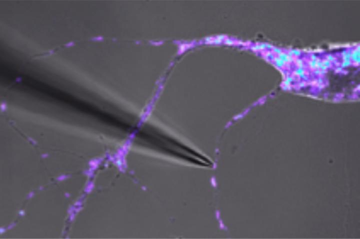 Manual isolation of a single mitochondrion to extract mitochondrial DNA.