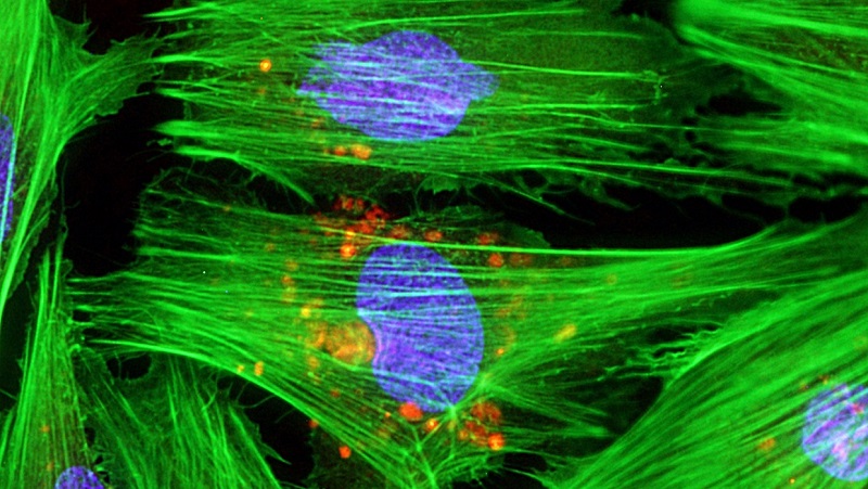 Heart muscle cells. One use of stem cell therapy is to treat heart disease.