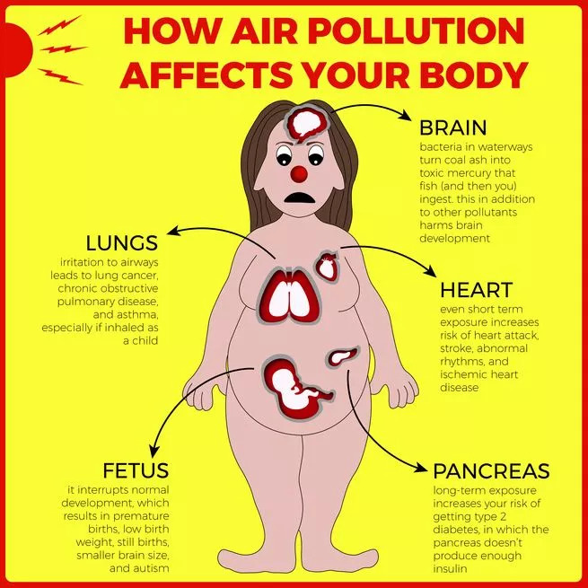 Health effects of air pollution.