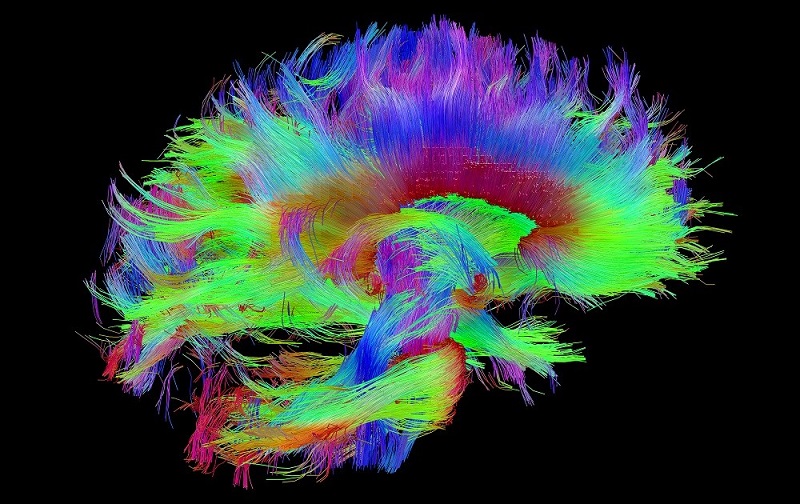 Scientists use brain mapping to find Parkinsons treatment.