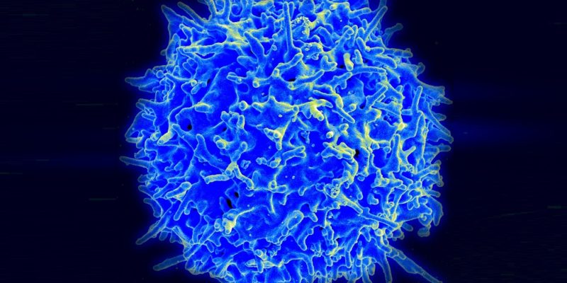 T cell therapy to treat cancer