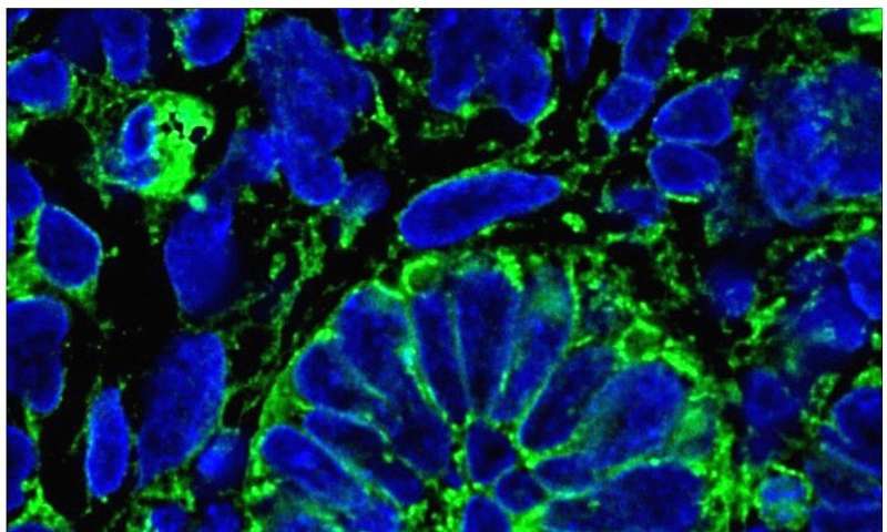 Lab grown kidney glomeruli, create functioning kidneys.