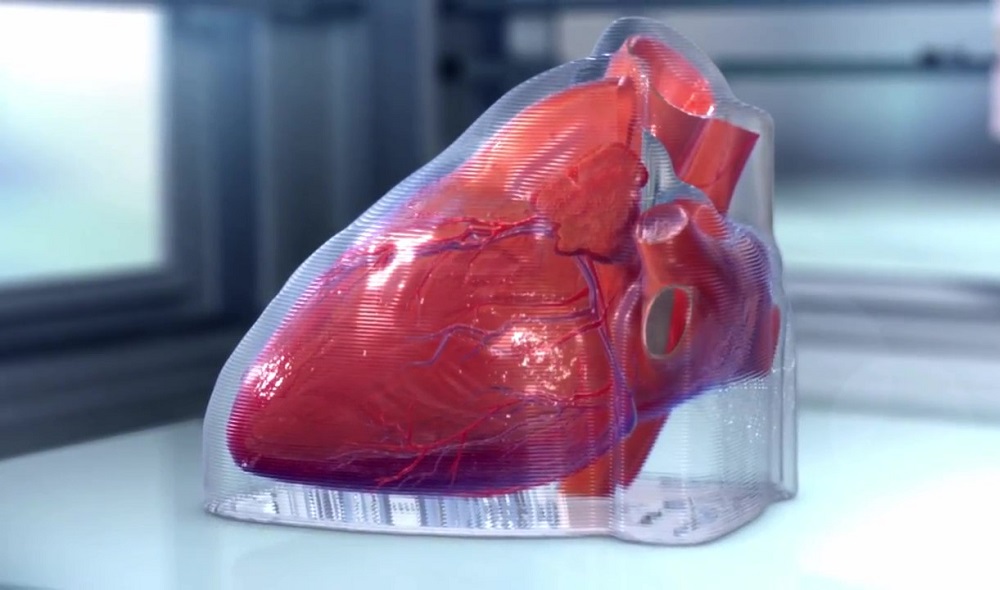 bioprinted Heart grown from stem cells