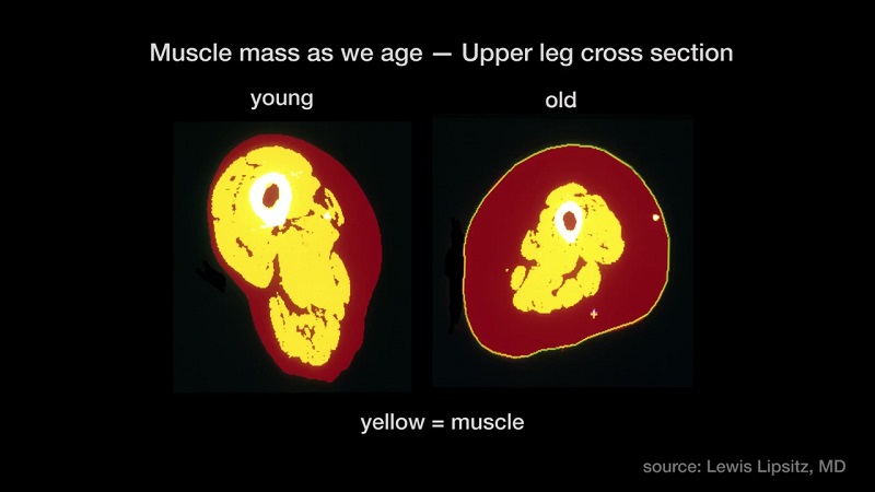 Decline in NAD causes aging blood vessels and loss of muscle tissue says Dr. David Sinclair. 