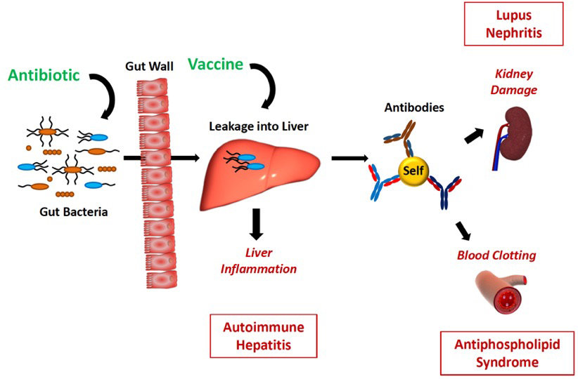 gut bacteria fuel autoimmune disease