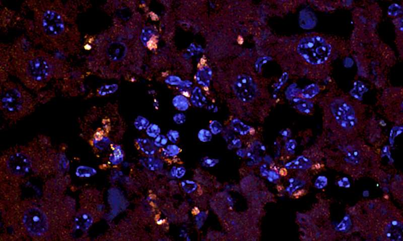 Orange dots mark the E. gallinarum bacteria which have translocated into the liver to trigger autoimmune disease.