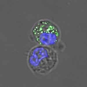 Autophagy_in_macrophage (1)