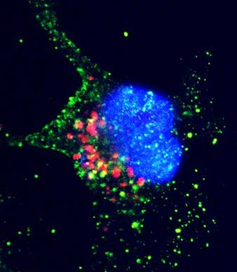 cells induces apoptosis, shown by active caspase-3 (green) staining.