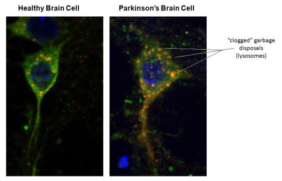 Autophagy falls down on the job and macromolecular damage builds up